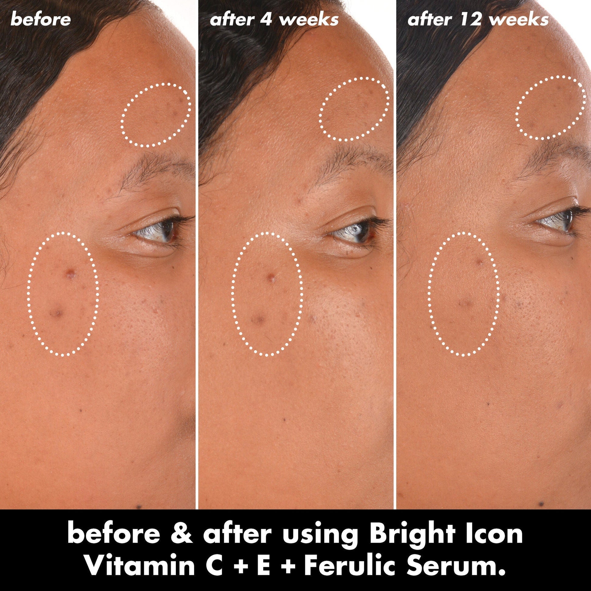 bright-icon-vitamin-c-e-ferulic-serum-y2 0226_EDU_BrightIconVitC_BA_Chanel_TRIPTYCH_c58f2fc8-209d-414f-9ba3-666a07a94887.jpg