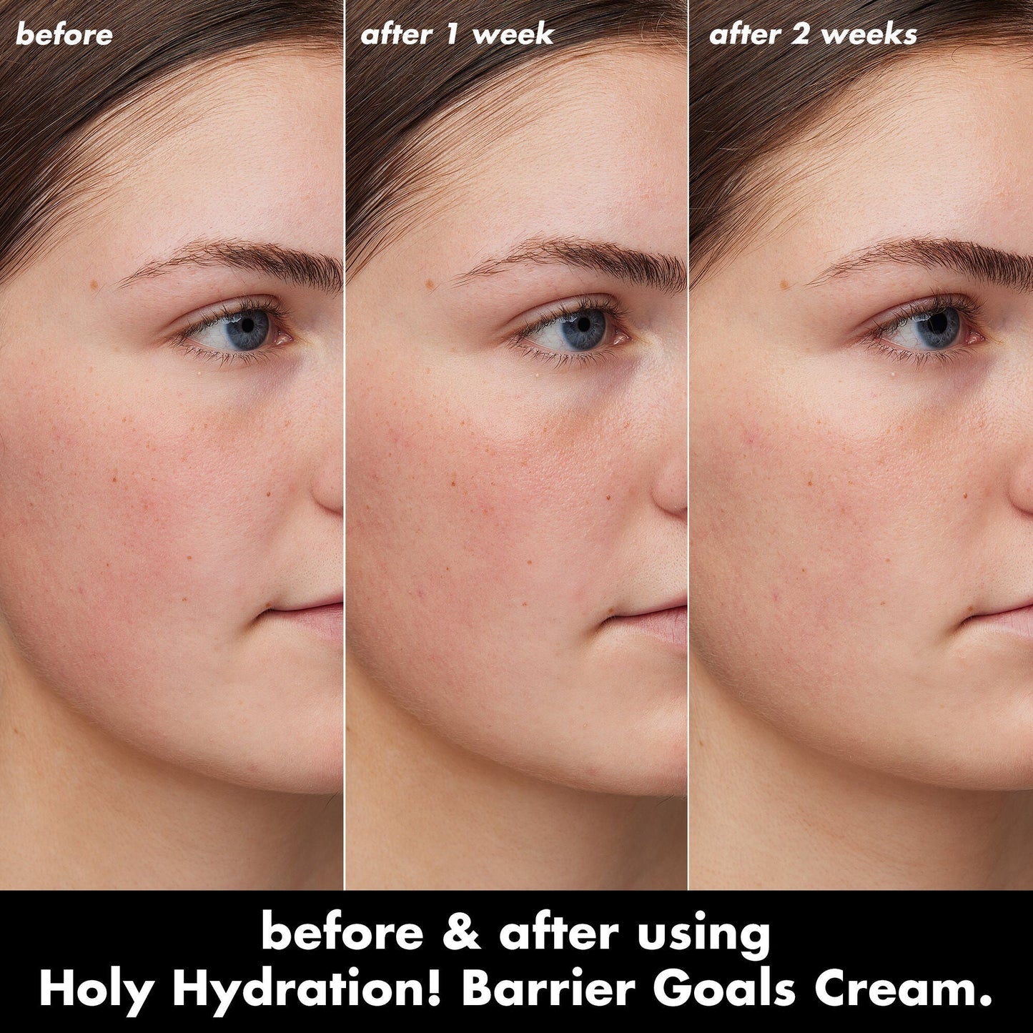 holy-hydration-barrier-goals-cream-h6 0226_EDU_HHBarrierGoalsCream_B_A_Zoe_TRYPTICH_710f5249-3a6b-41fd-89e4-817294dd9258.jpg