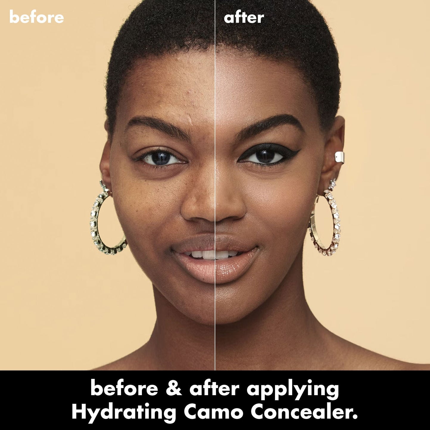 hydrating-camo-concealer-e8 0226_EDU_HydratingCamoConcelaer_BA_AshleyKaresh_20_1_d8499bbf-0e91-4173-b5e2-75127caf83a3.jpg