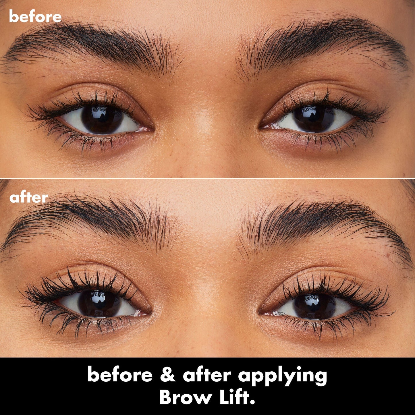 brow-lift-h1 0326_EDU_BrowLift_BA.jpg