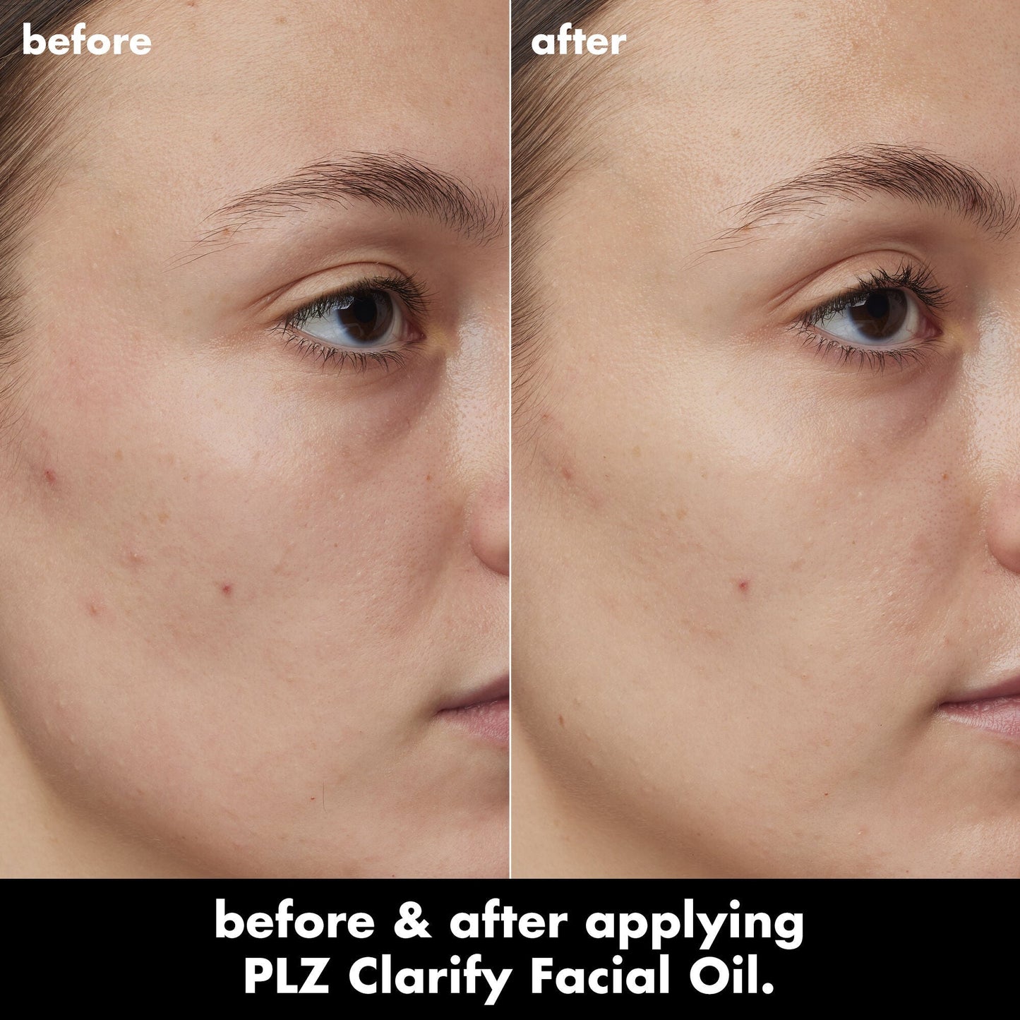 plz-clarify-facial-oil-h2 0326_EDU_PlzClarify_BA_Kelly.jpg