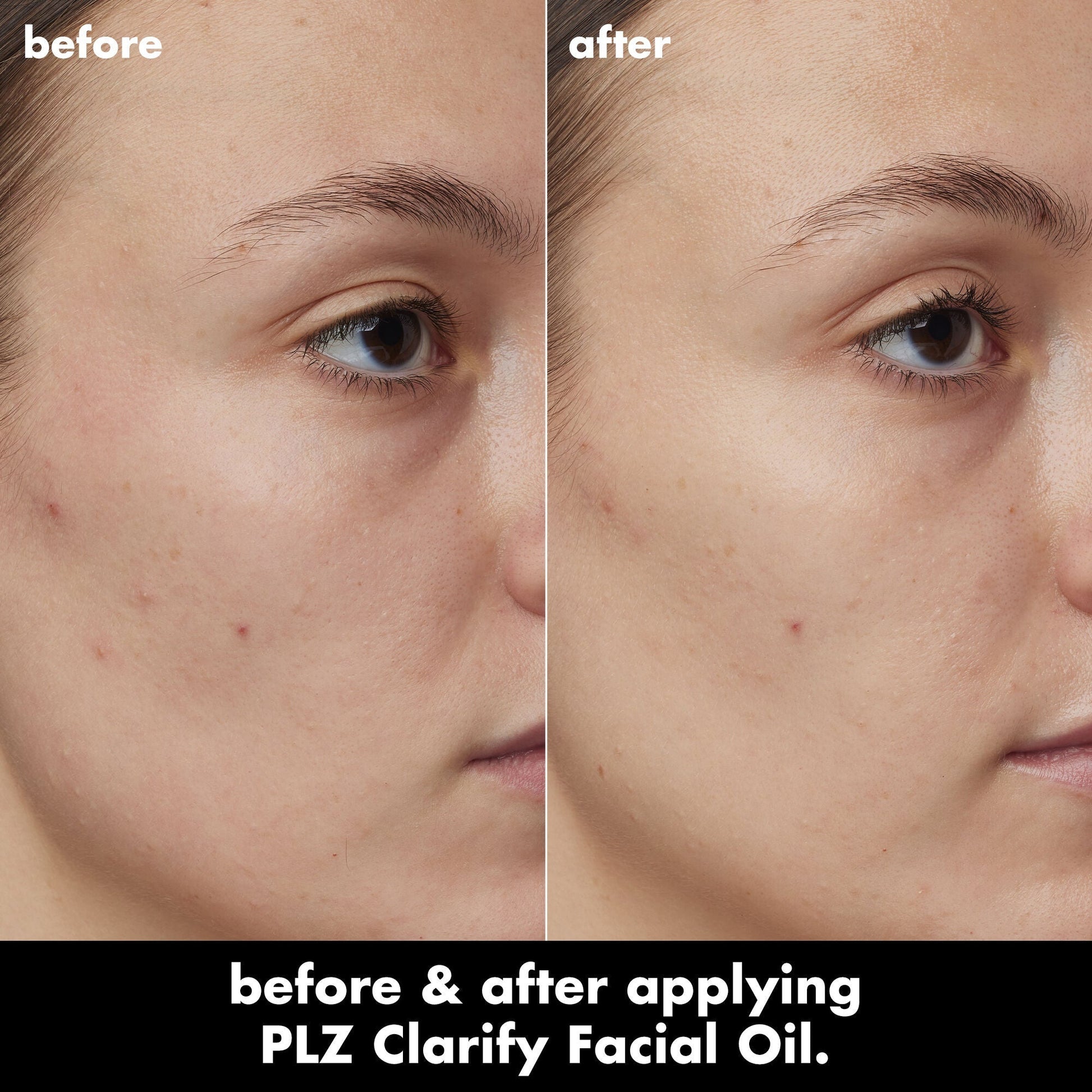 plz-clarify-facial-oil-h2 0326_EDU_PlzClarify_BA_Kelly.jpg