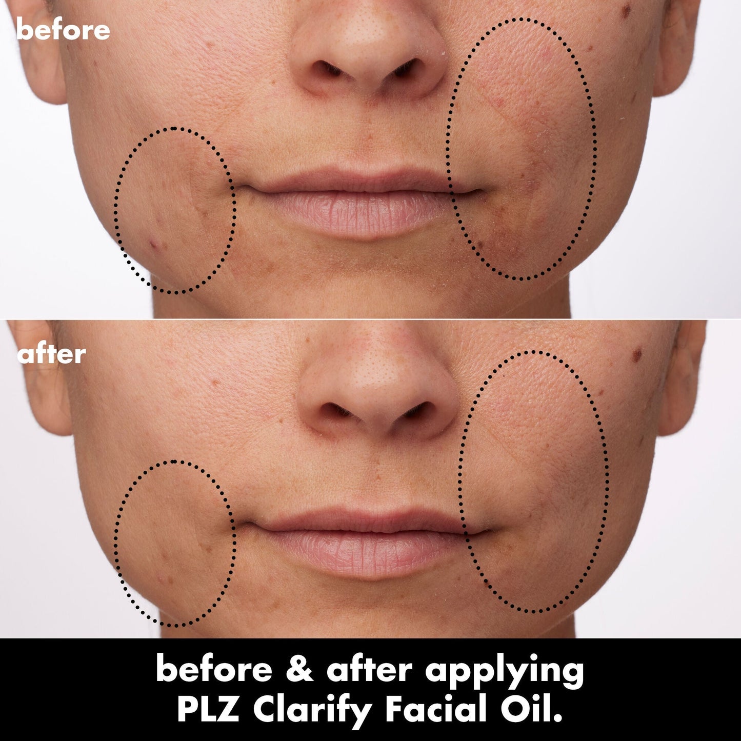 plz-clarify-facial-oil-h2 0326_EDU_PlzClarify_BA_Paula.jpg