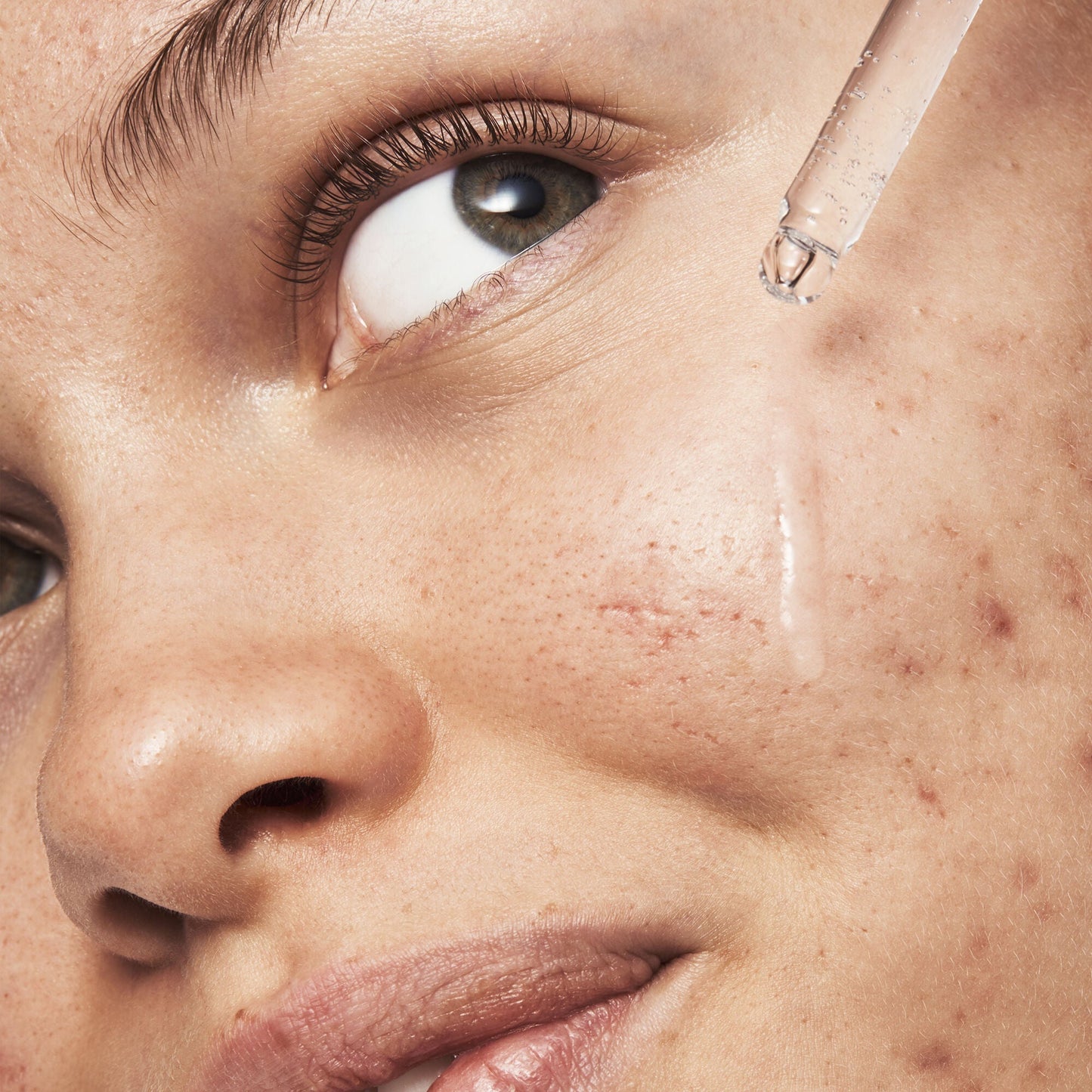 blemish-breakthrough-triple-acid-resurfacing-serum-l9 121321_Marley-Acne-Regimen_0254_FINAL_IGF.jpg