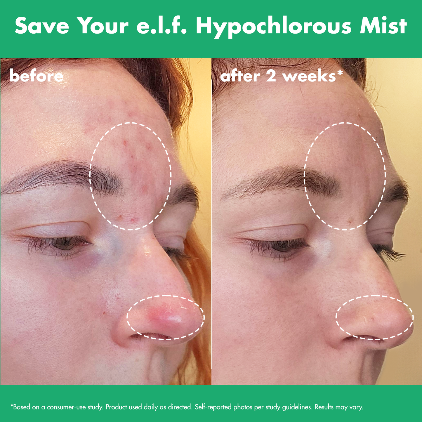 save-your-e-l-f-hypochlorous-mist-c6 FA26_EDUCATION_SAVEYOURELF_USAGE_BA1_WITHOUT_CLAIMS.png