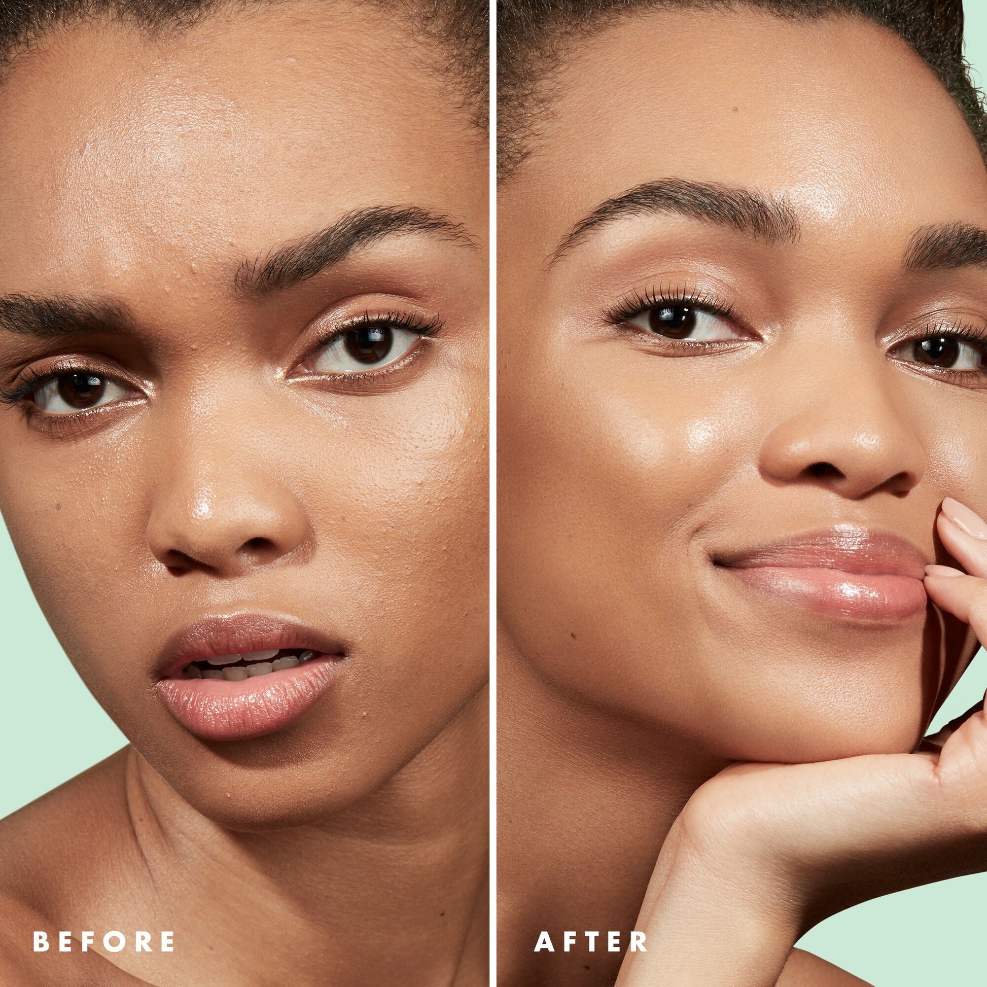 blemish-control-face-primer-large-size-z9 Primer_PP_Before_After_BlemishControl_2000x2000_3774231e-d4e1-49dd-b3d7-a73cbac901fe.jpg