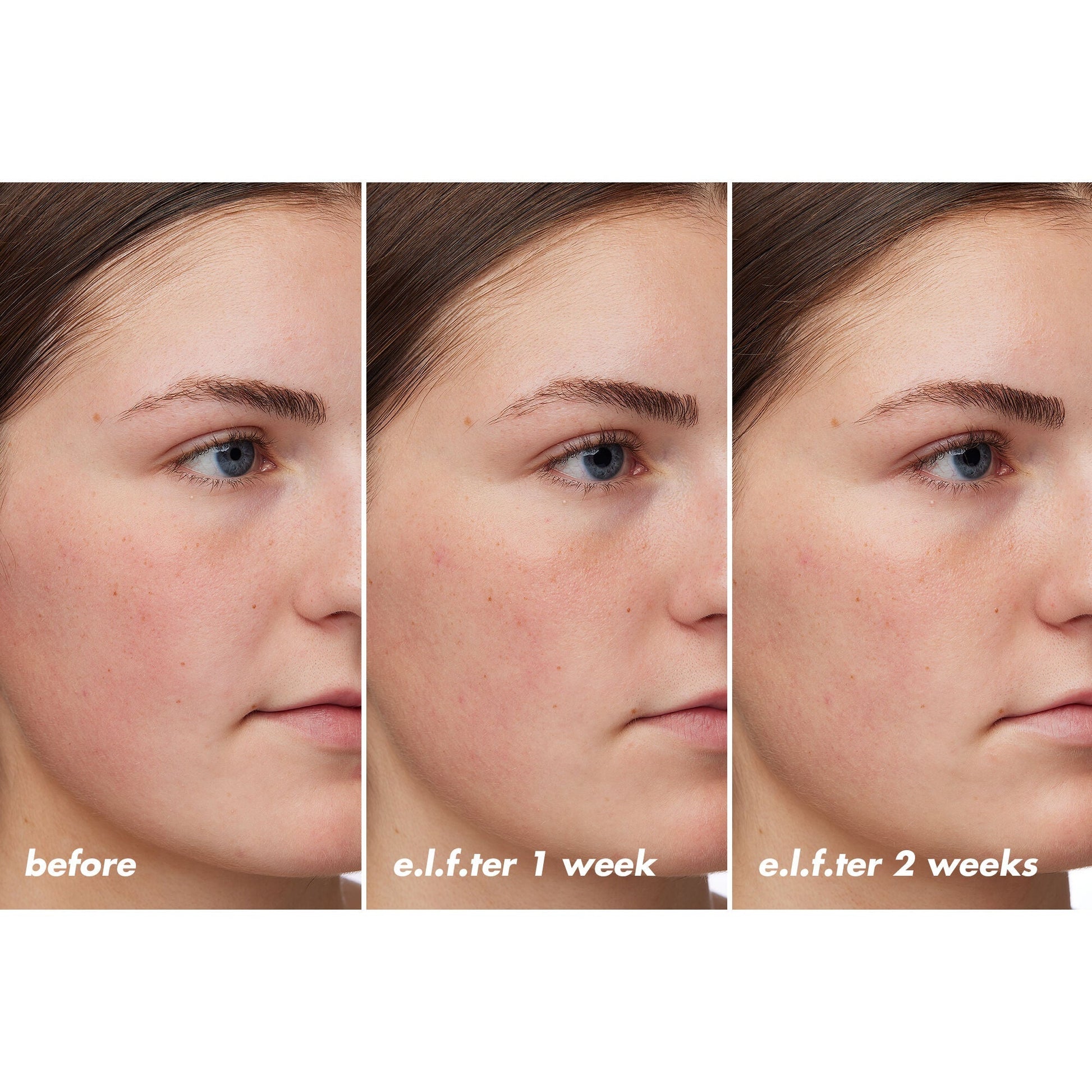 holy-hydration-barrier-goals-cream-regular-c0 XX26_EDUCATION_HH-BarrierGoals_B_A_Zoe_TRYPTICH_74c905bd-67bd-4b91-b633-2b01a8905cb8.jpg